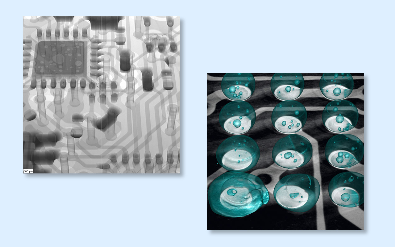 4. 2D vs 3D CT X-ray Which One Do You Really Need? 4. 2D CT X-Ray vs 3D CT X-Ray 어떤 것이 정말 필요한가요?