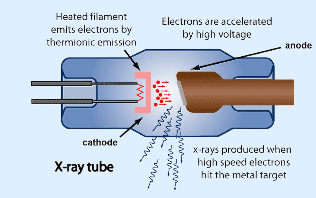 2. What X-ray Technology Actually Does 2. 엑스레이 기술이 실제로 하는 일